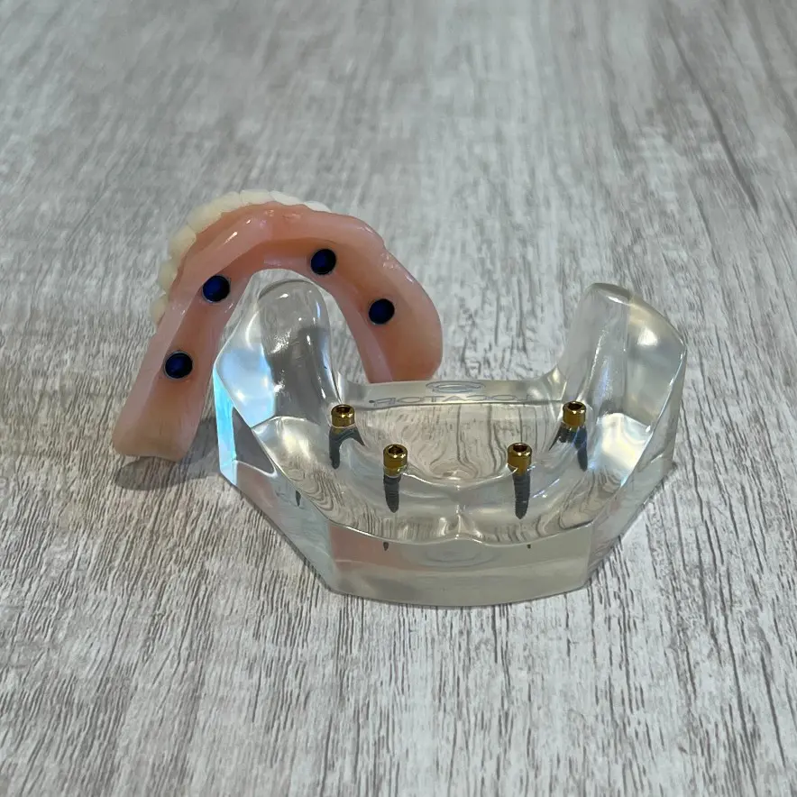 snap-in implant dentures Edmond, OK